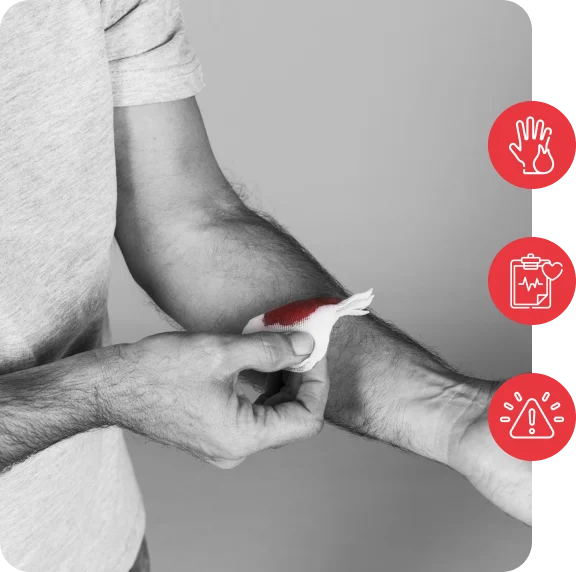 ER Treatment for Burns in Pearland