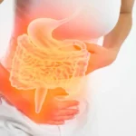 Illustration showing abdominal pain linked to irritable bowel syndrome.