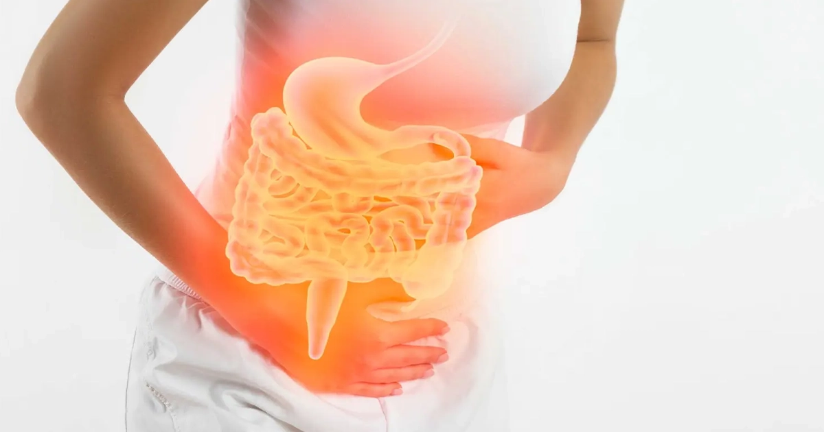What Causes Irritable Bowel Syndrome