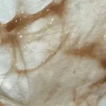 Brown mucus discharge possibly caused by dried blood.