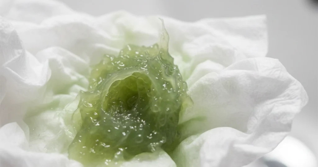 Green mucus indicating possible respiratory infection signs.