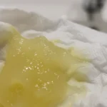 Yellow mucus indicating possible sinus or respiratory infection.