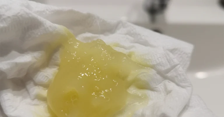 Why Is My Mucus Yellow