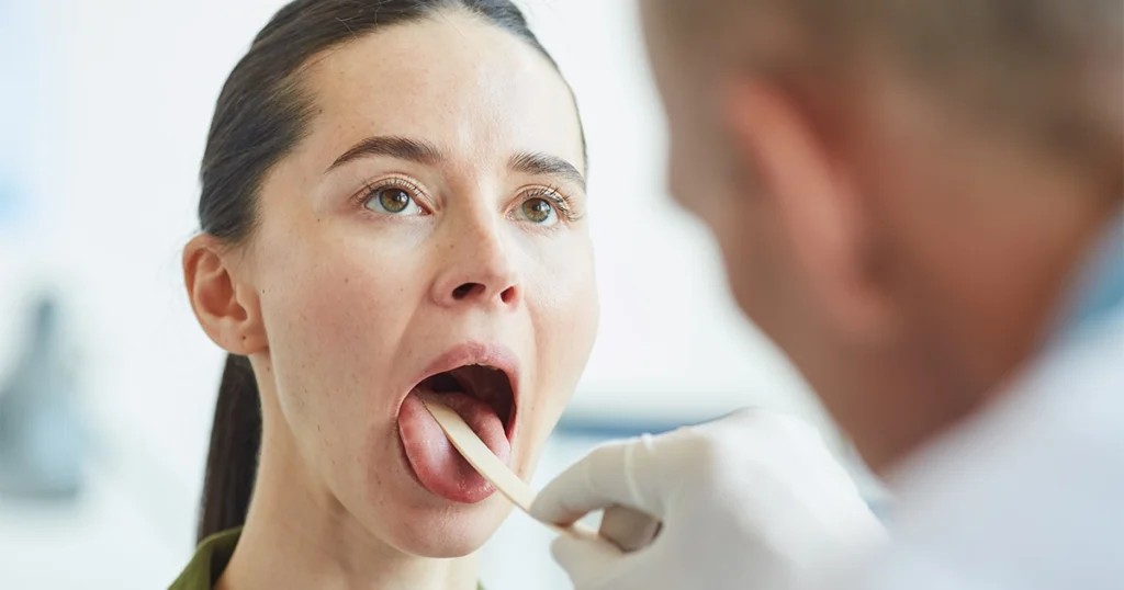 Doctor examining throat for tonsil stones during checkup.