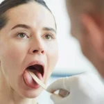 Doctor examining throat for tonsil stones during checkup.