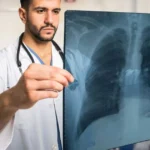 Male doctor in a white coat reviewing a chest X-ray of human lungs.