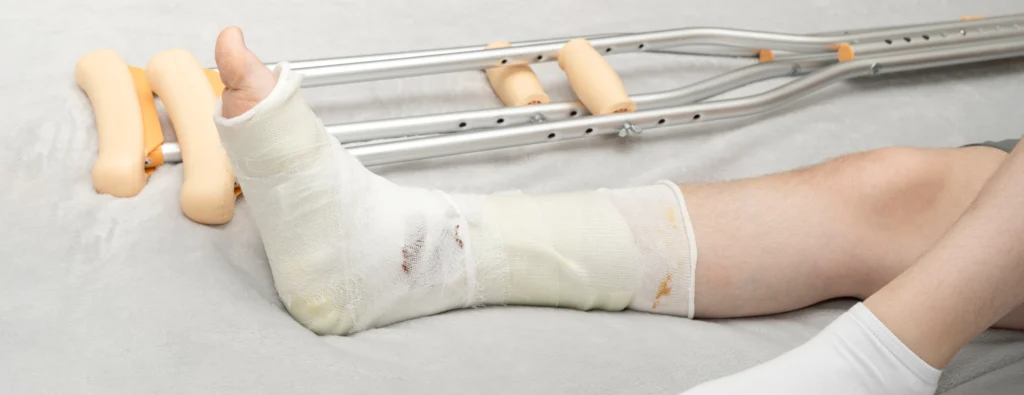 Trauma and Fractures