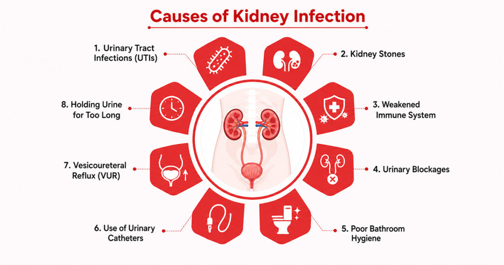 Infographic showing causes of kidney infections